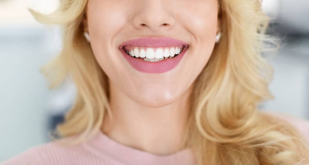 Belleville teeth whitening Services